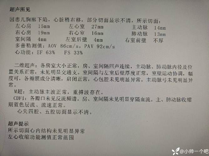 拱墅区最新疫情通报：寻找同轨迹人员_拱墅新型冠状病毒肺炎确诊病例