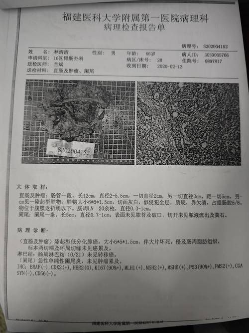 监利近期新增死亡病例1例/监利发布
