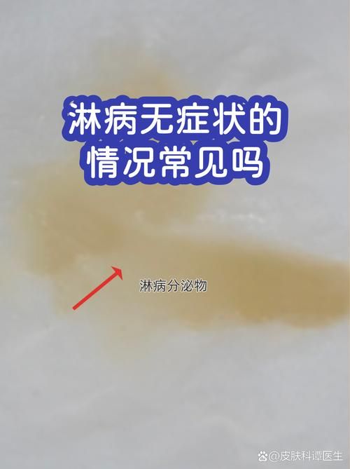 广西壮族自治区南宁西乡塘区新增16例无症状感染者及28例无症状/南宁西乡塘区新型冠状病毒