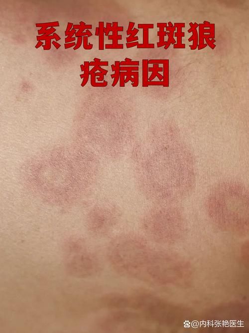 云南省红河哈尼族彝族自治州蒙自市现有无症状感染者4例_云南省红河州蒙自市新型冠状病毒