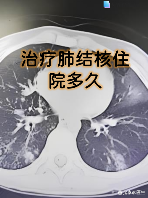  山东省临沂市临沭县新增19例重症，涉及辽宁葫芦岛南票区:临沭感染新型肺炎