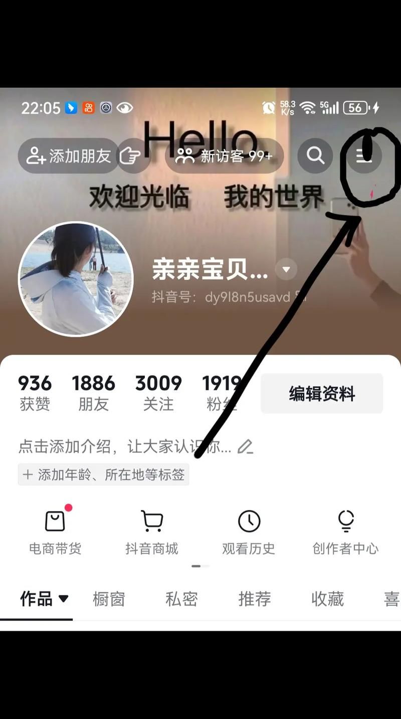 抖音粉丝-技术解答