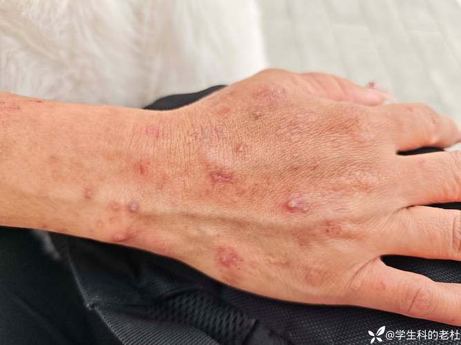【玛纳斯县现有阳性感染者8例_玛纳斯县玛纳斯镇】