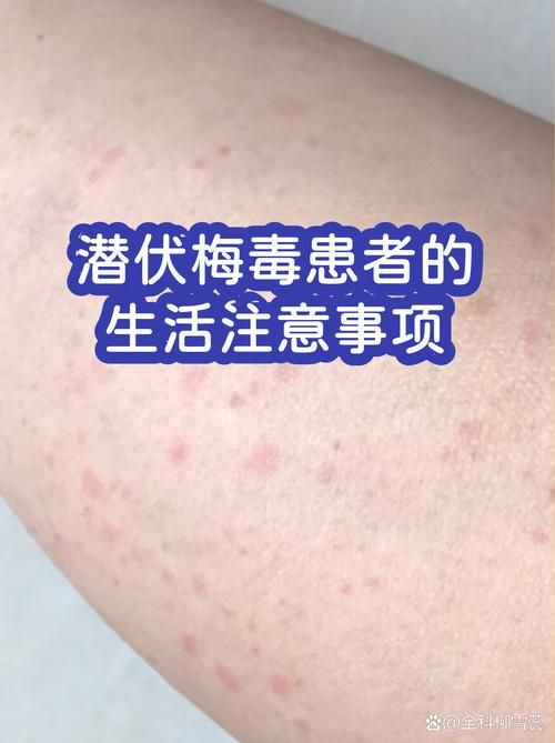 泗阳县静默区无症状感染者详情/泗阳最新