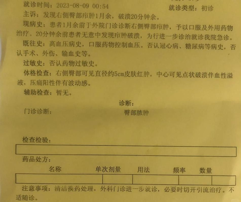 新疆维吾尔自治区伊犁哈萨克自治州新源县累计报告死亡病例28例的简单介绍