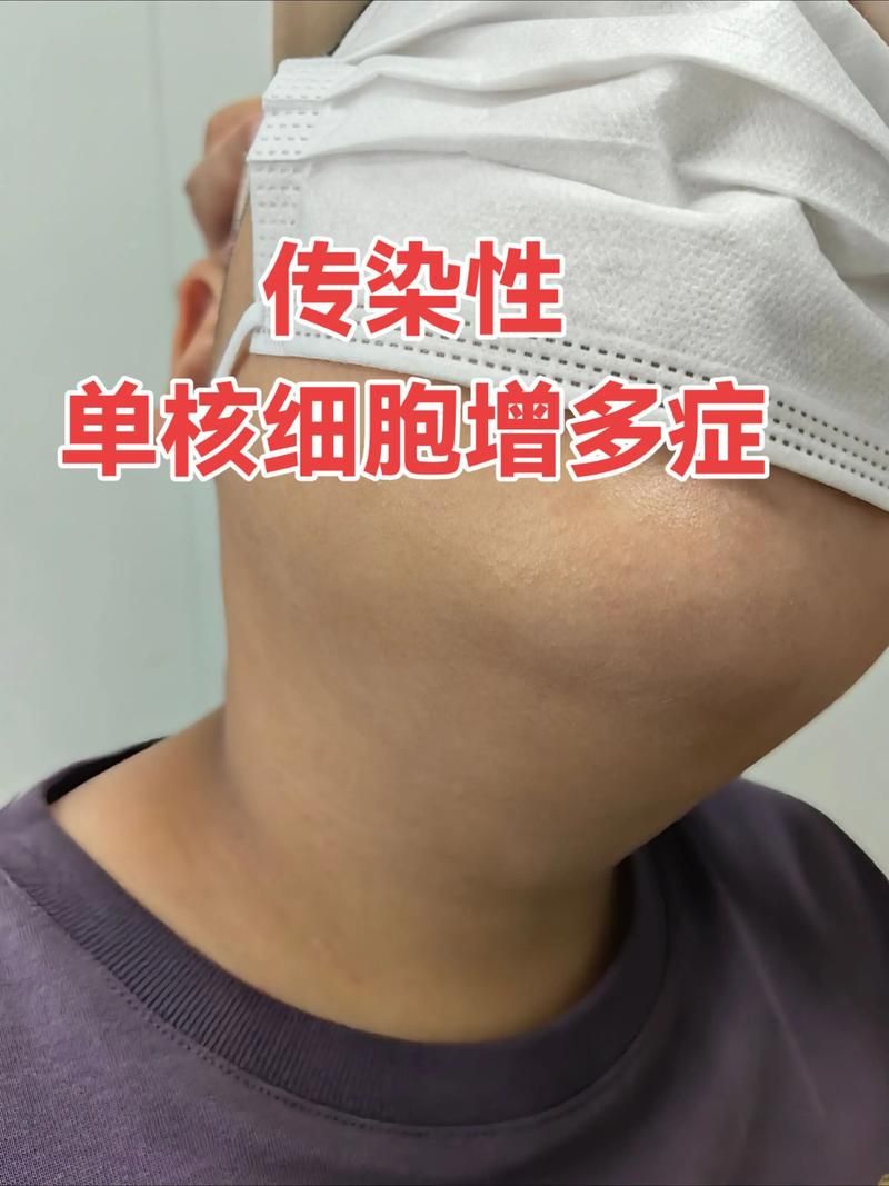 黑龙江省哈尔滨市五常市9月30日新增9例无症状感染者:2021年1月黑龙江五常市有疫情吗