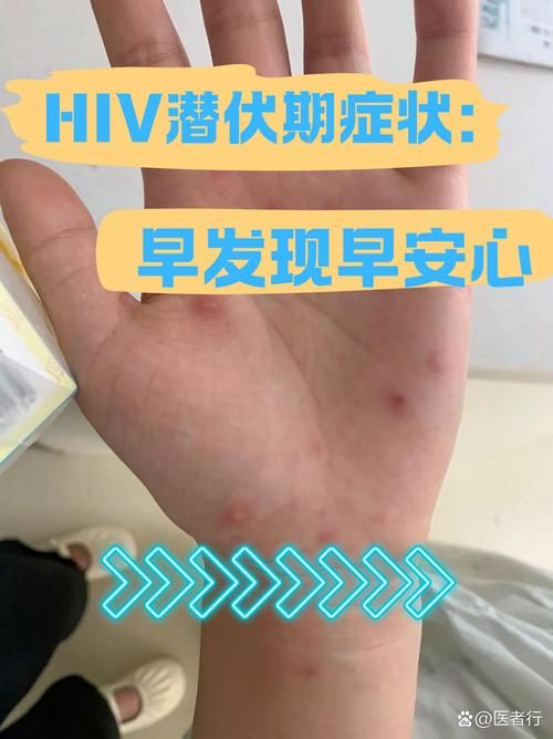 吉林吉林吉林经济开发区静默区无症状感染者详情/吉林市2名新型病毒情况