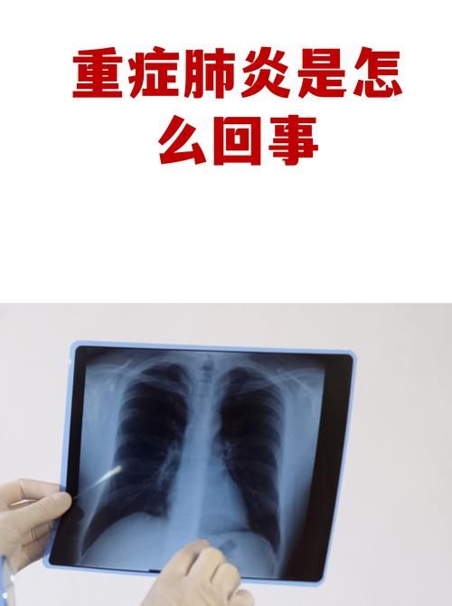 河北保定莲池区有什么疫情地区/保定市莲池区有新冠肺炎吗