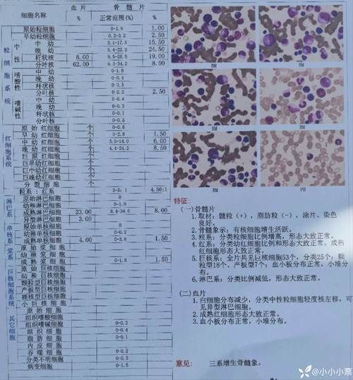  疫情数据黑龙江佳木斯富锦疫情防控最新文件:黑龙江佳木斯富锦新冠病毒