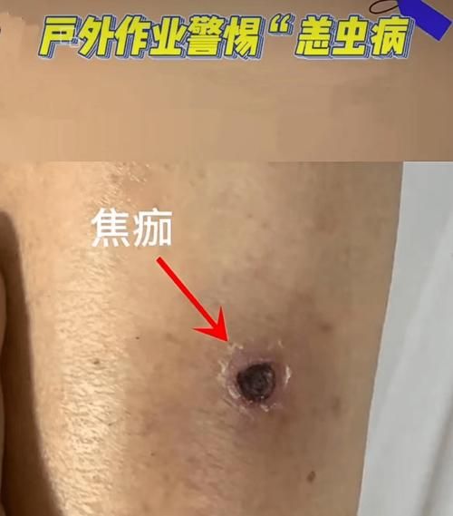 泰州1月16日本土确诊疫情数据_泰州确诊一例