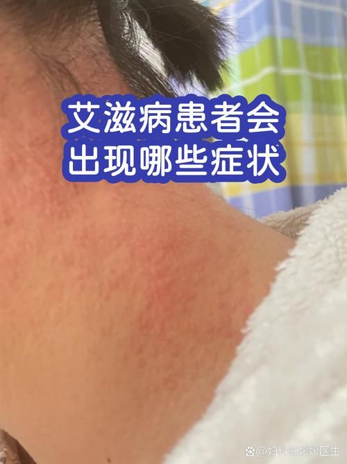 【全球新增无症状感染者30例_全球一年新增130万艾滋病感染者】